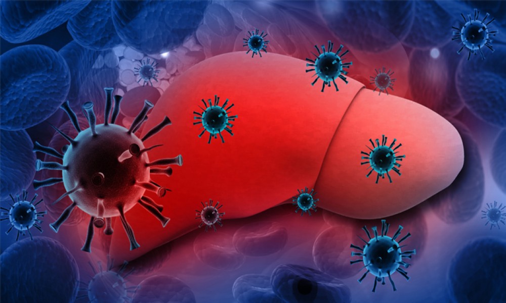 Svetski dan virusnog hepatitisa - kasno se otkriva, a mogao bi se brzo izlečiti