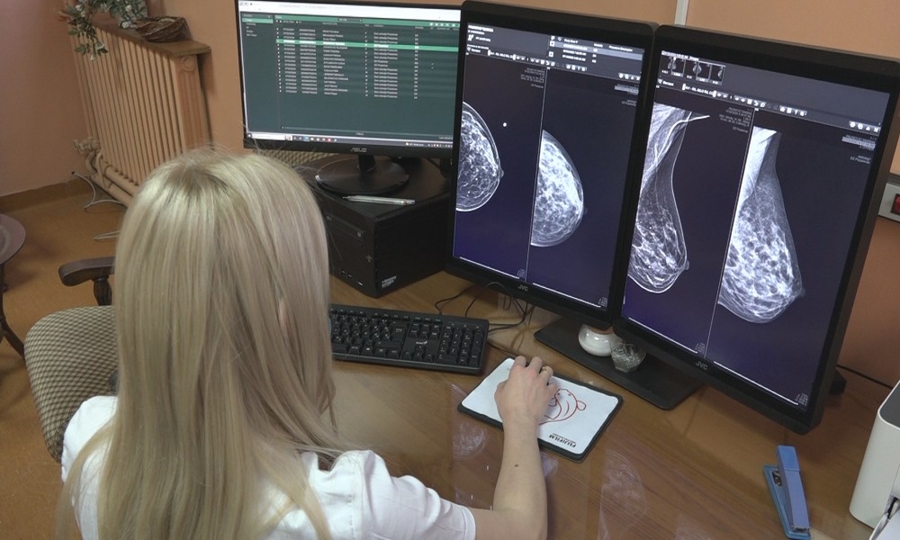 Apel ženama da se odazovu na skrining mamografiju